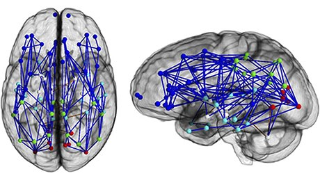 Carte neurologique d'un cerveau masculin