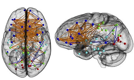 Carte neurologique d'un cerveau féminin