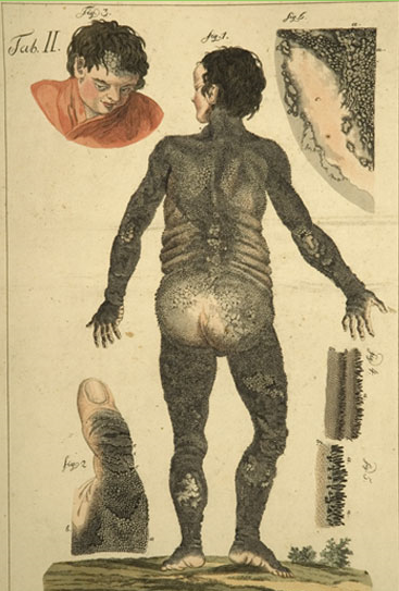 Edward Lambert vu de dos