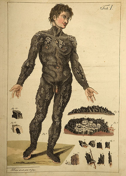 Edward Lambert vu de face