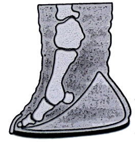 Pied d'éléphant