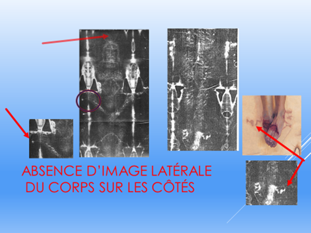 Absence d'image latérale